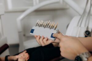 відбілювання зубів у Львові