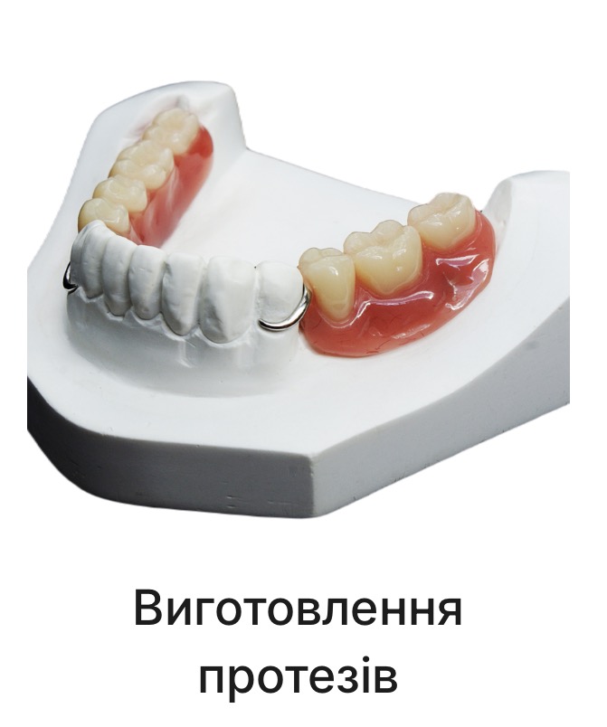 Виготовлення протезів