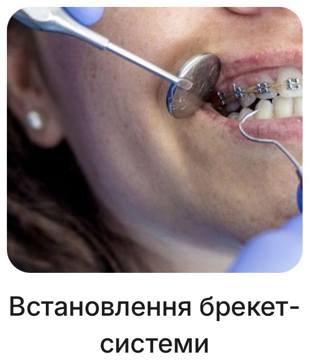 Zakładanie aparatu ortodontycznego